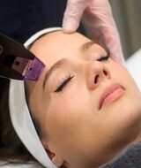 Book an Appointment with Morpheus8 - Prix à discuter at La clinique Versa MD situé à Montréal